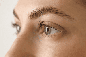 brow lift benefits, is a brow lift right for me
