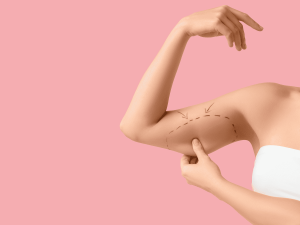 Patient enjoying smooth, sculpted arms after an arm lift procedure in Salt Lake City at Ward Institute.