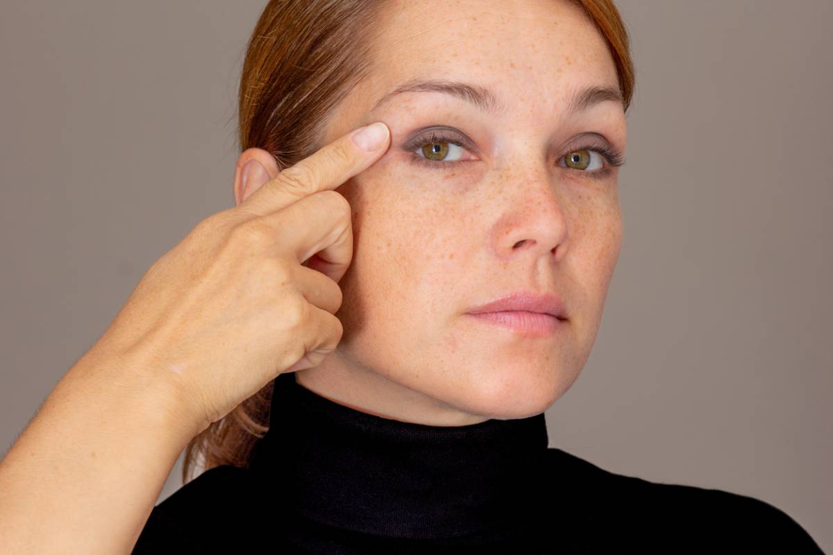 Read more about the article Why Do My Eyelids Look Asymmetrical After Surgery?