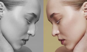 rhinoplasty recovery