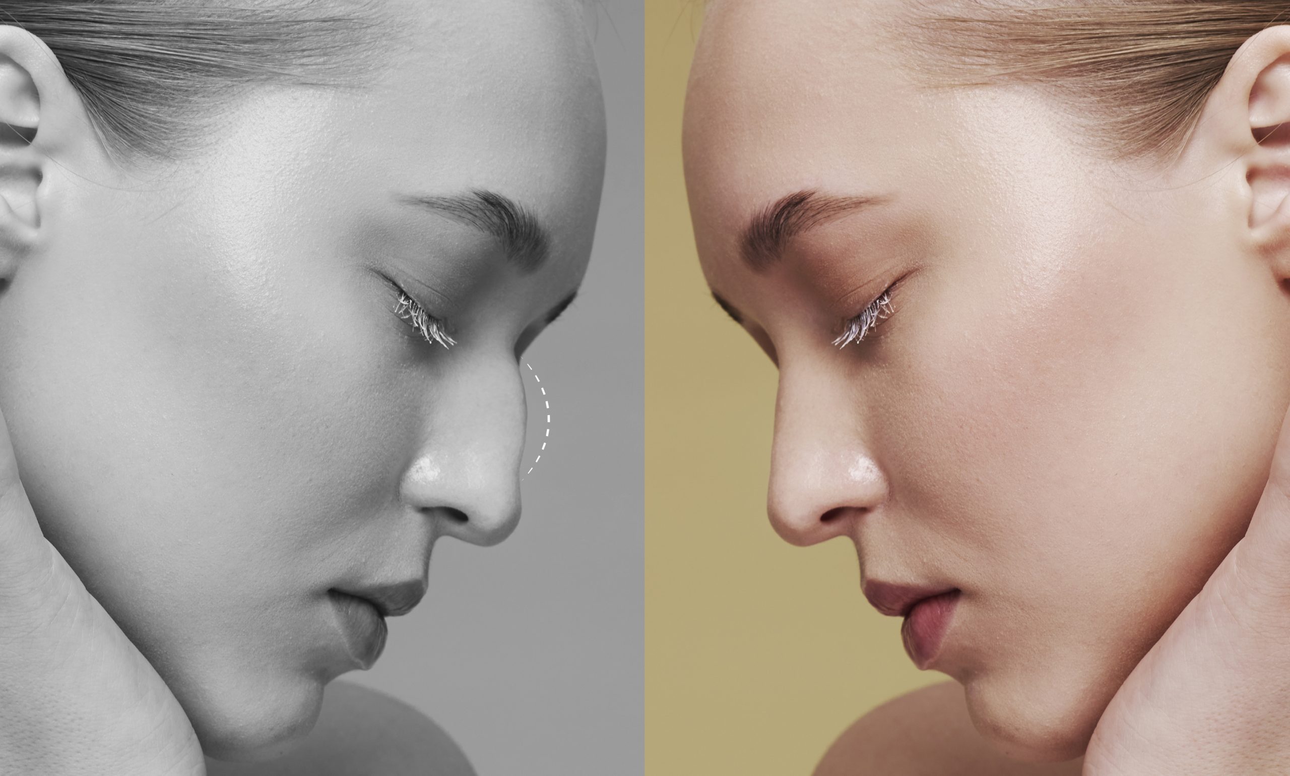 Read more about the article Rhinoplasty Recovery Timeline: What to Expect Week by Week
