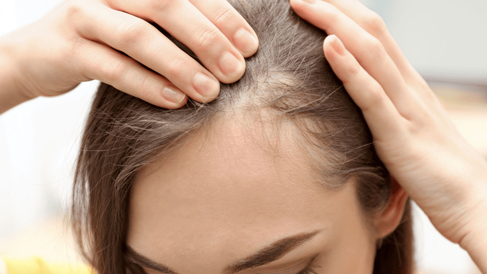 Read more about the article Breaking Myths About Hair Loss and Restoration