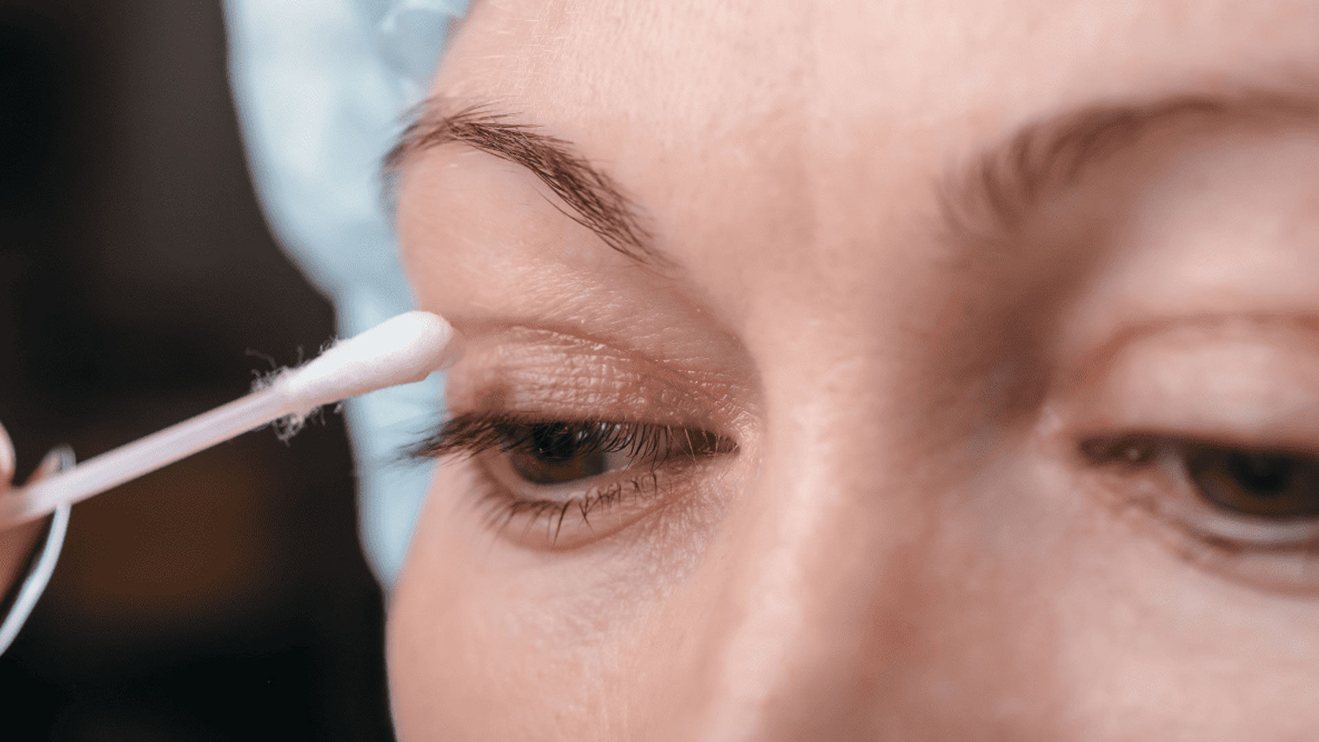 Read more about the article From Aging to Genetics: Why Upper Eyelid Changes Happen